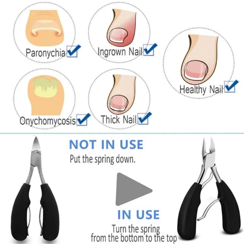 Fingernail & Toenail Clipping Tool-6